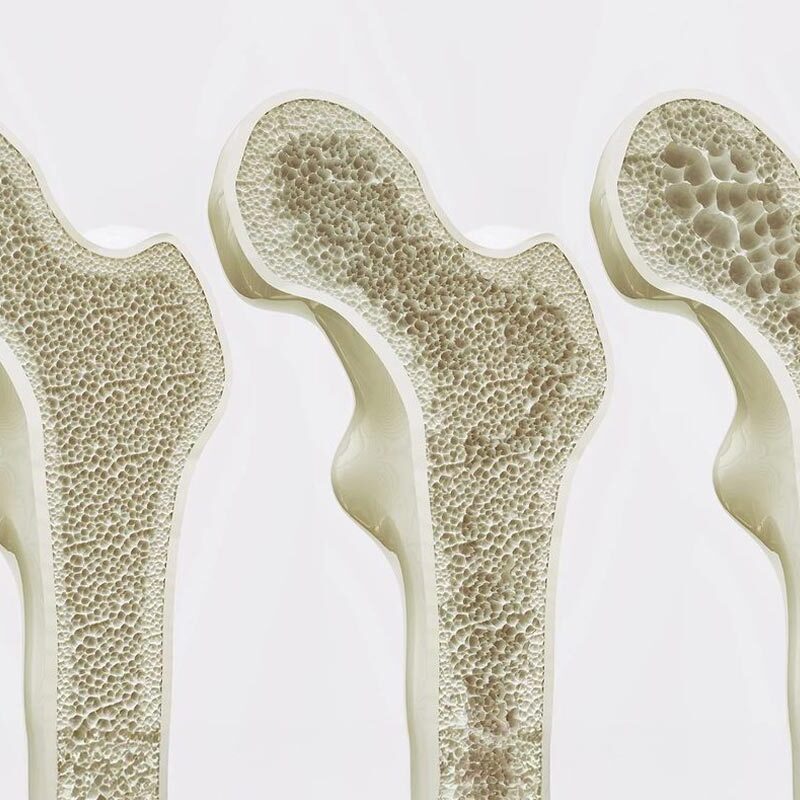 Nutrients Required for Strong Bones including calcium rich foods, vitamins and minerals for bone health